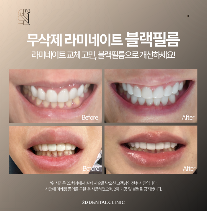 무삭제라미네이트비용 라미네이트 교체도 문제없어요 관련 이미지 9