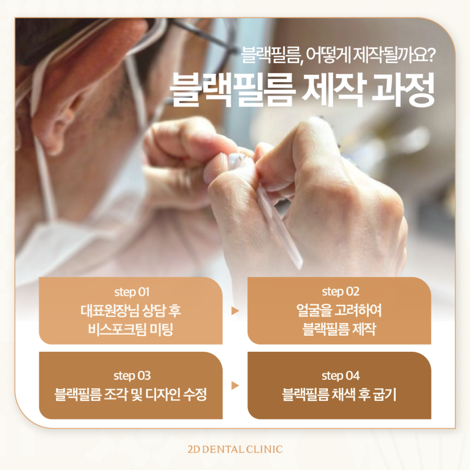 대치동치과 앞니치아변색 개선하는 무삭제 블랙필름 제작은? 관련 이미지 4