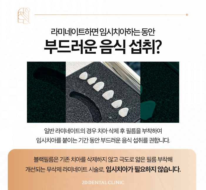 강남라미네이트 무삭제 블랙필름 관리하는 법 관련 이미지 4