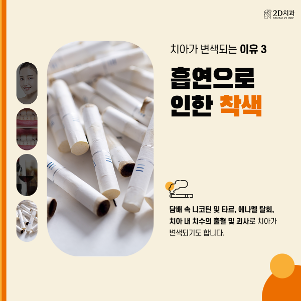 치아착색음식 때문? 양치해도 치아가 누런 이유 관련 이미지 4