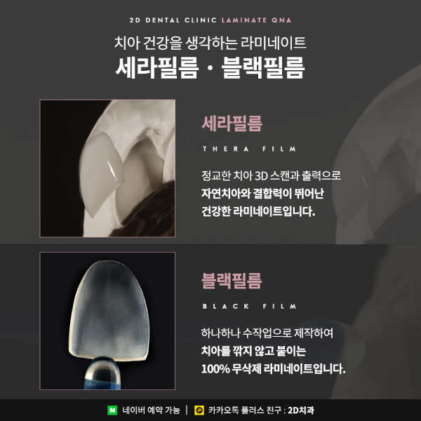 라미네이트 시술 전이라면? 이건 관련 이미지 6