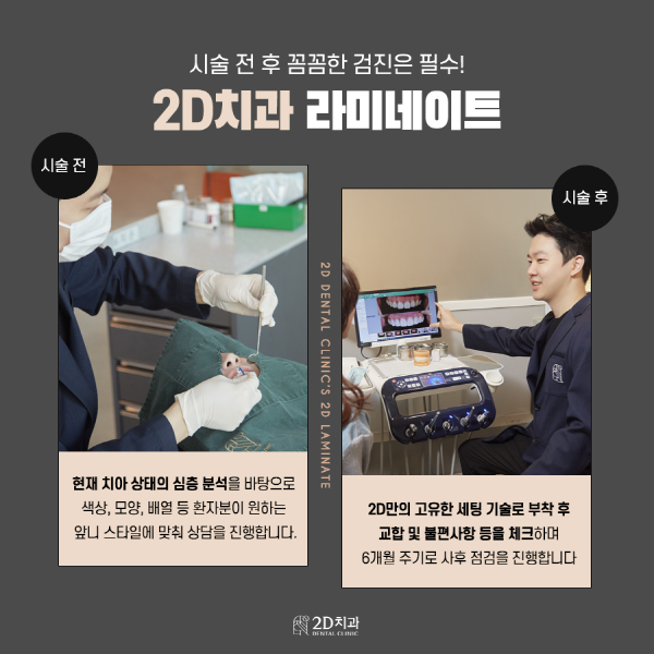 "이것만은 꼭 지켜줘" 라미네이트 시술 후 주의점 관련 이미지 6