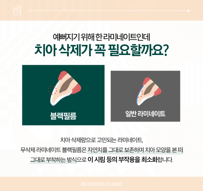소중한 자연치 손상 없는 치아무삭제라미네이트 블랙필름 관련 이미지 4