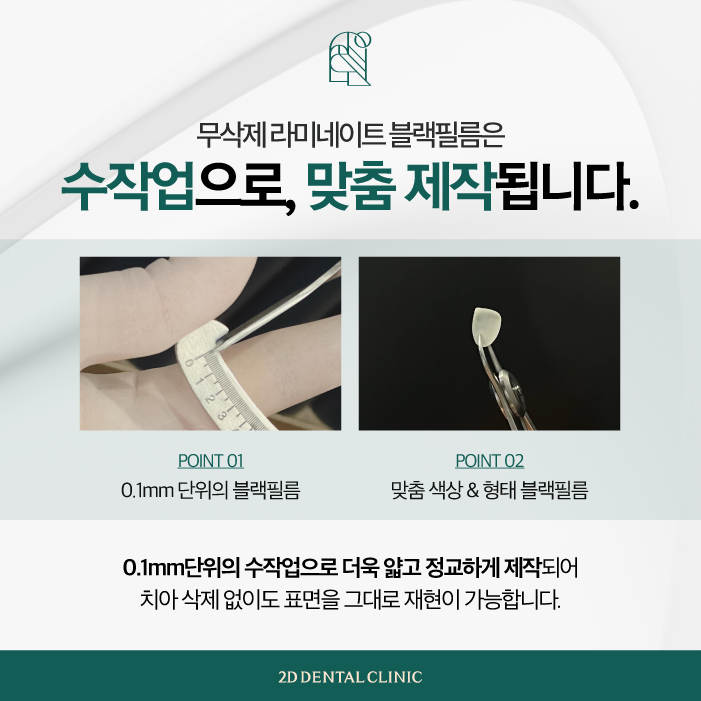 투디치과 무삭제블랙필름 아름다운 앞니 자신감 관련 이미지 5