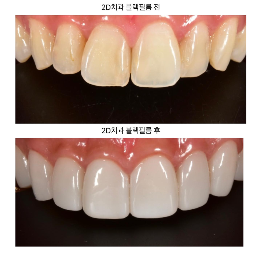 연예인 무삭제라미네이트 블랙필름 제작과정 관련 이미지 7
