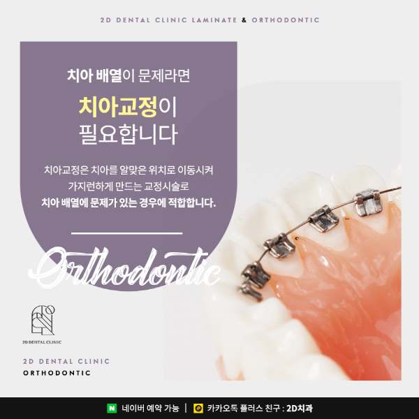 "치아 콤플렉스 극복" 치아 교정과 라미네이트중 뭐가 더 좋을까? 관련 이미지 3