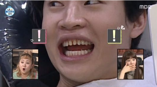 라미네이트 빠짐 대처법 관련 이미지 3