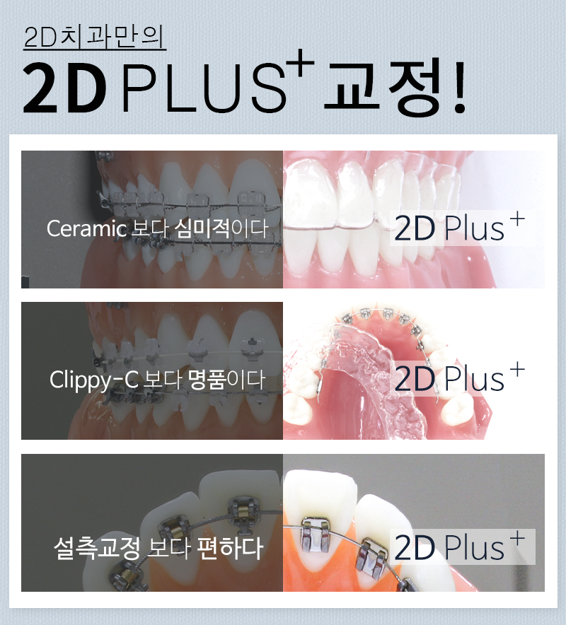 2D Plus+(플러스) 교정, 심한 케이스도 티 나지 않게! 관련 이미지 5