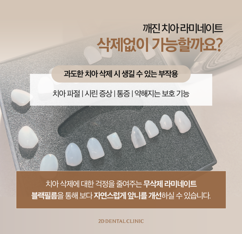 대구무삭제라미네이트 앞니깨짐 보완하며 자연스러움은 그대로! 관련 이미지 4