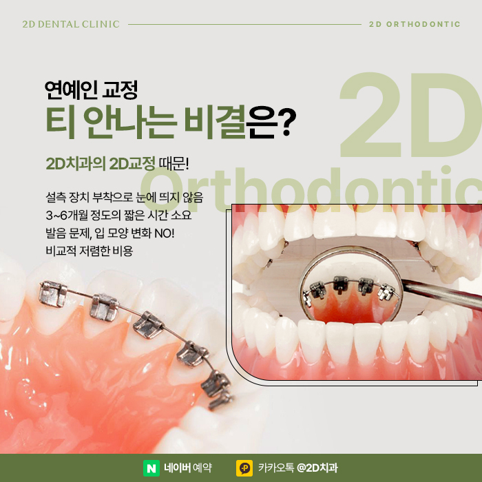 아무도 모르게 티 안나는 연예인교정으로 강남역 교정치과 관련 이미지 2