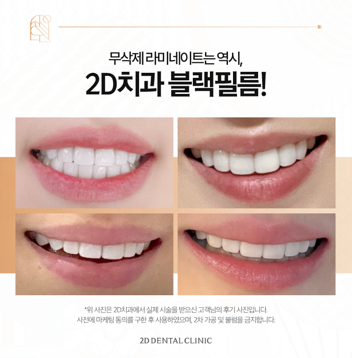 강남라미네이트 무삭제 블랙필름 관리하는 법 관련 이미지 7