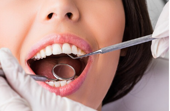 치아교정과 무삭제라미네이트 블랙필름 나에게 맞는 시술찾기 관련 이미지 8