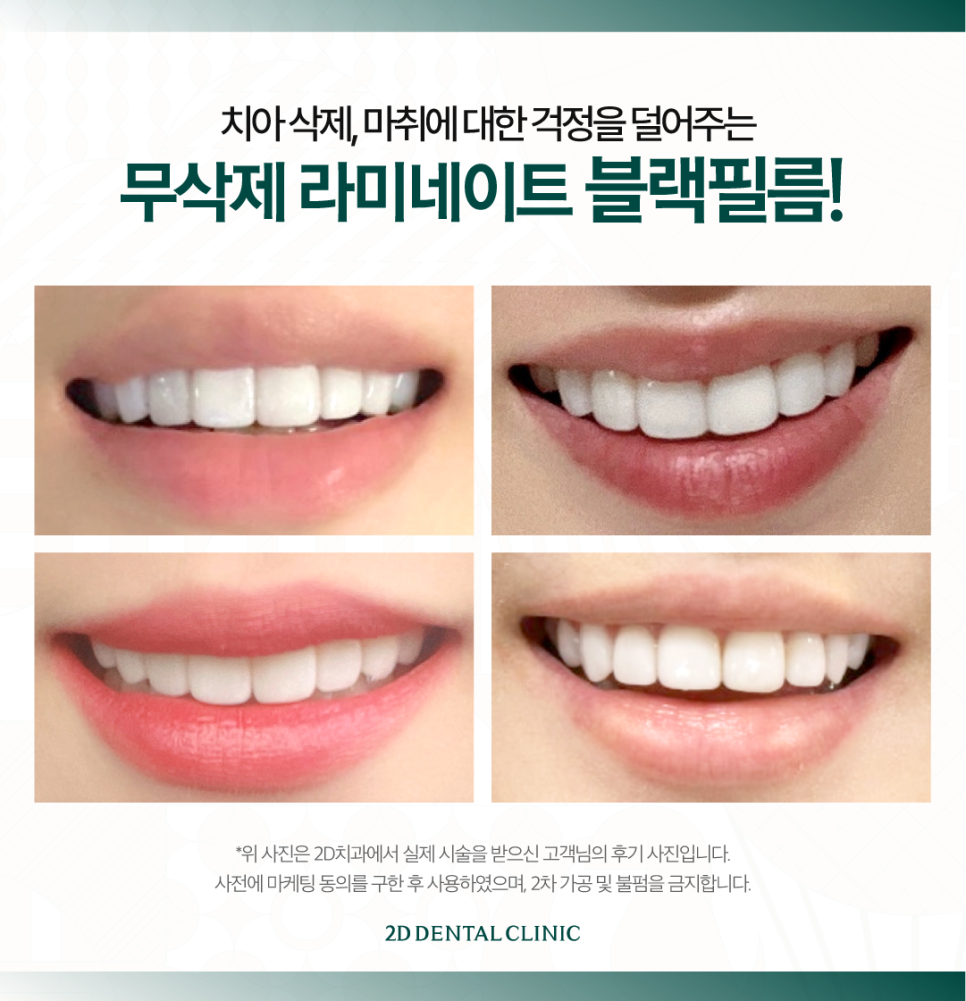 임산부라미네이트 치아 마취가 어려운데 가능한가요? 관련 이미지 7