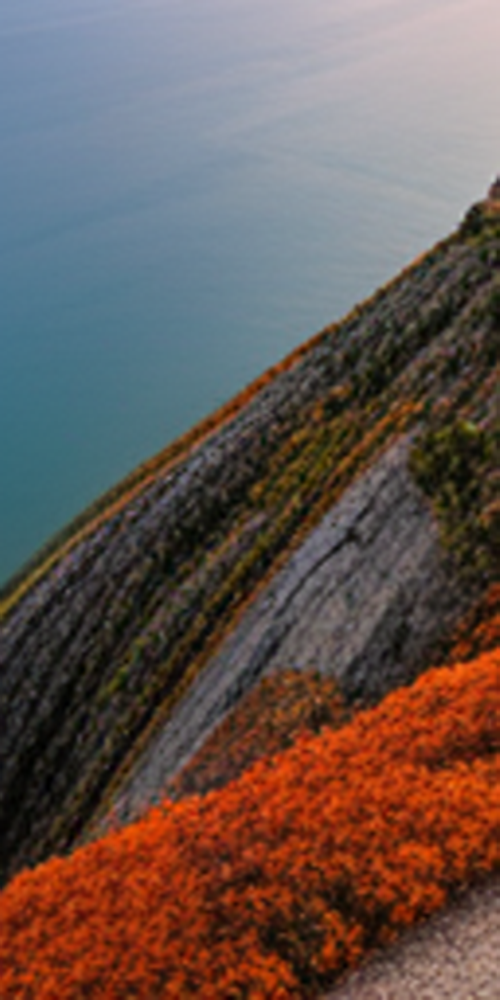 치과라미네이트 비용보다 중요한 것은? 관련 이미지 16