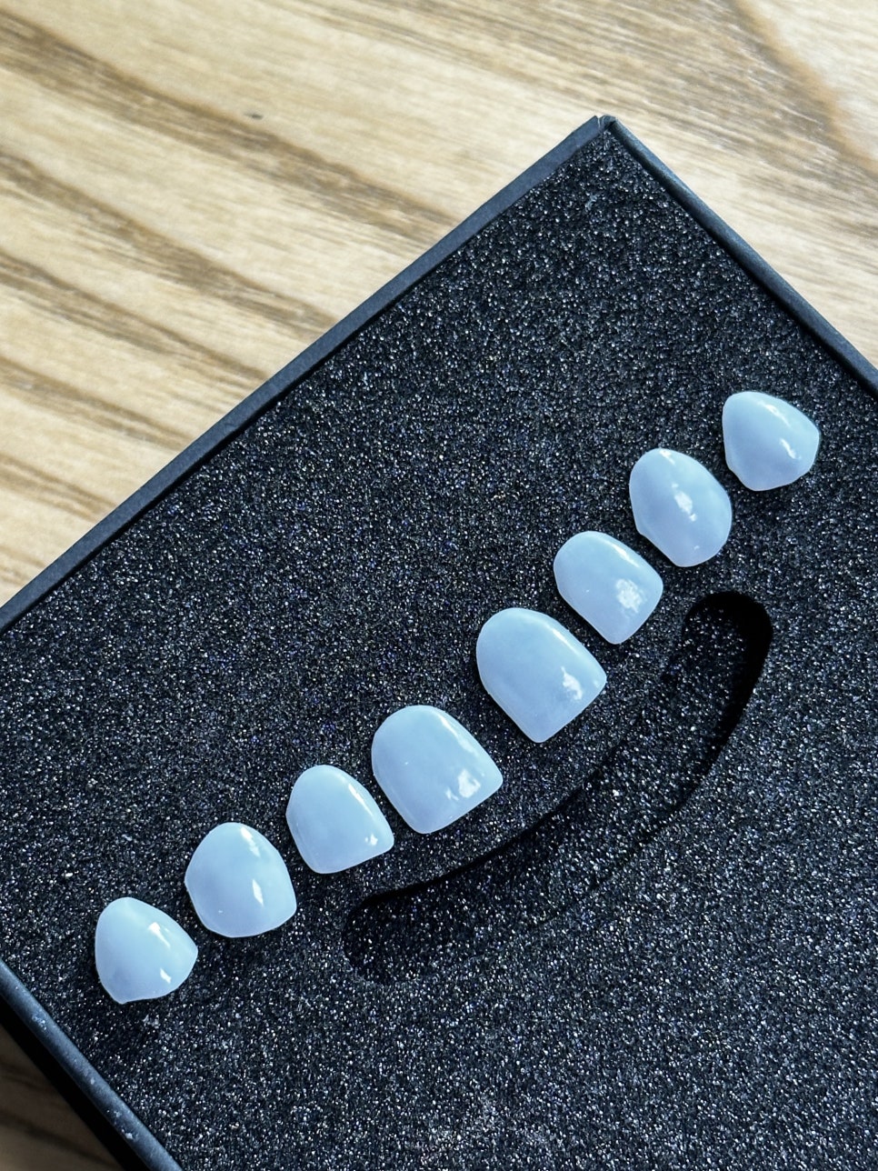 강남라미네이트 앞니변색 치아콤플렉스 개선은 블랙필름 관련 이미지 10