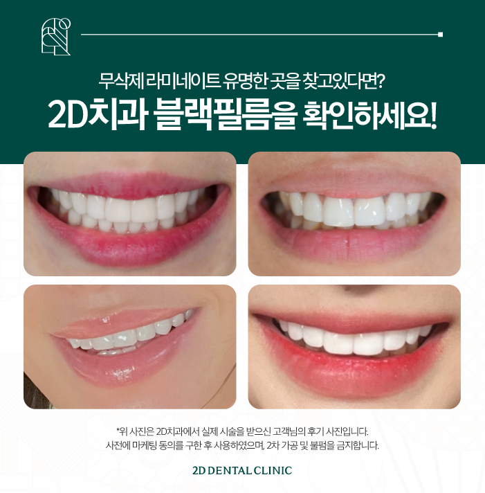 무삭제라미네이트가격 블랙필름이 인기 많은 이유는? 관련 이미지 6