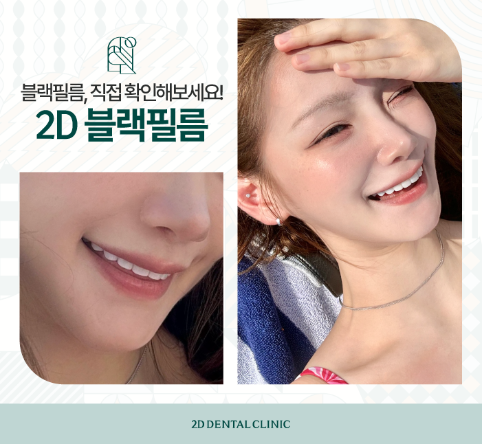 이 시림 없이 무삭제 라미네이트잘하는곳 관련 이미지 7