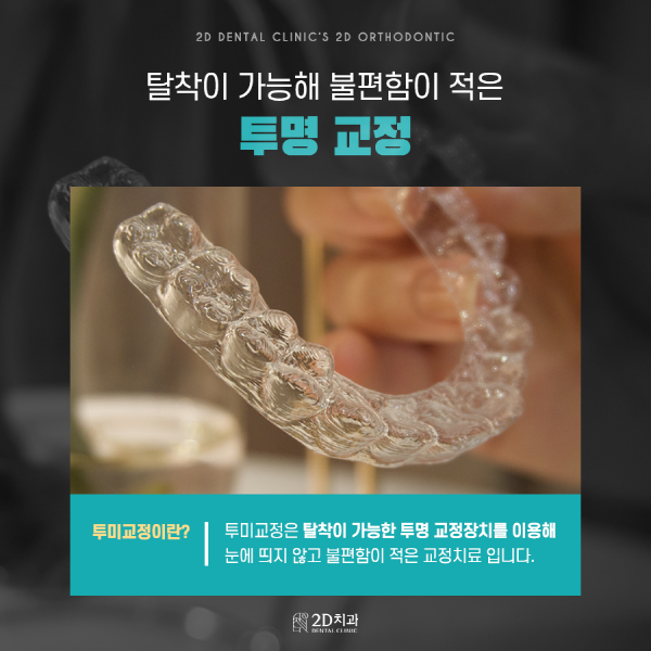 치아교정에 미백을 더하면? 2D치과 <투미교정> 관련 이미지 3
