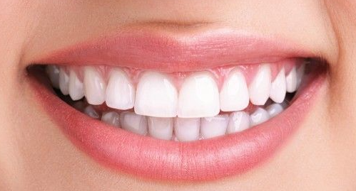 앞니 무삭제라미네이트 고객맞춤형 치아제작하는 블랙필름 관련 이미지 1