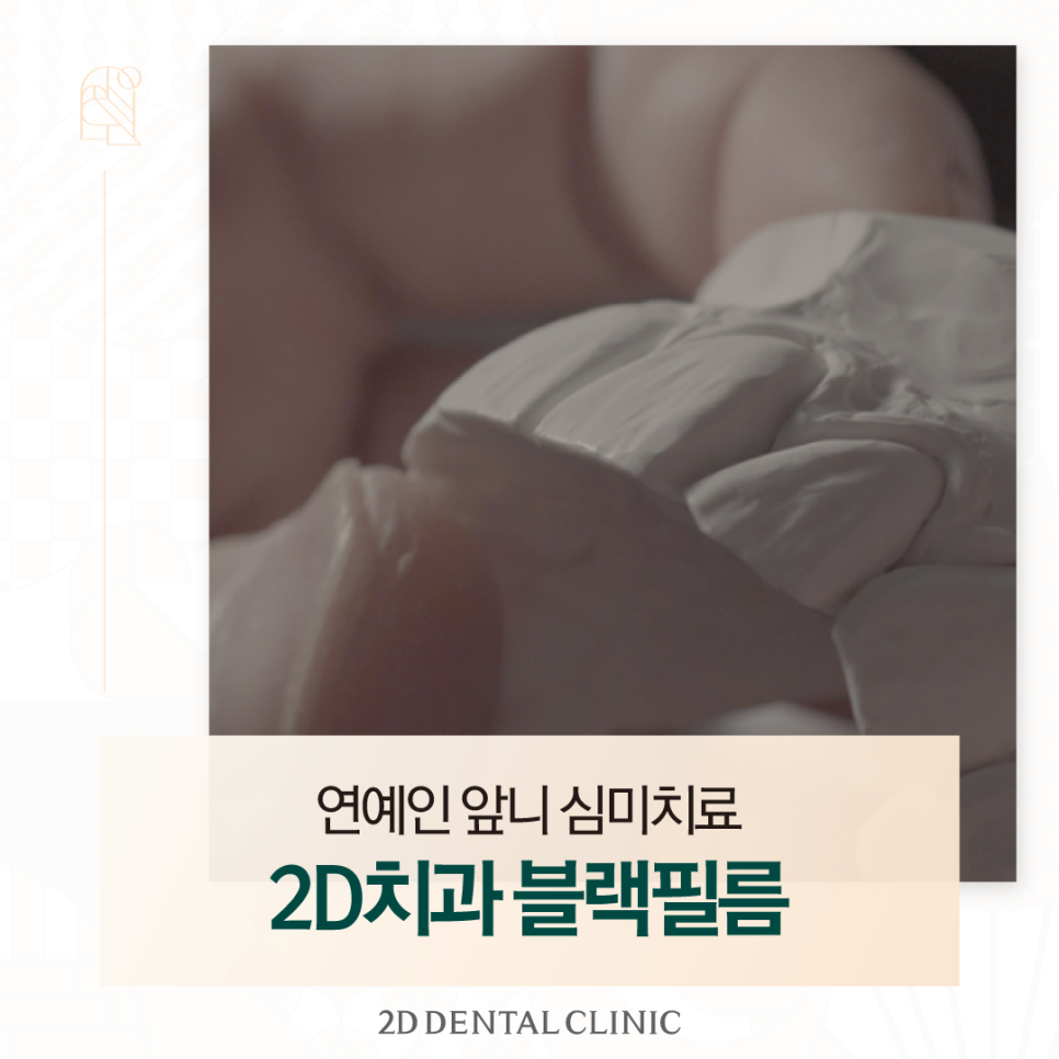광주무삭제라미네이트 앞니심미치료 깔끔한 치아가 그저 부러웠다면 관련 이미지 1