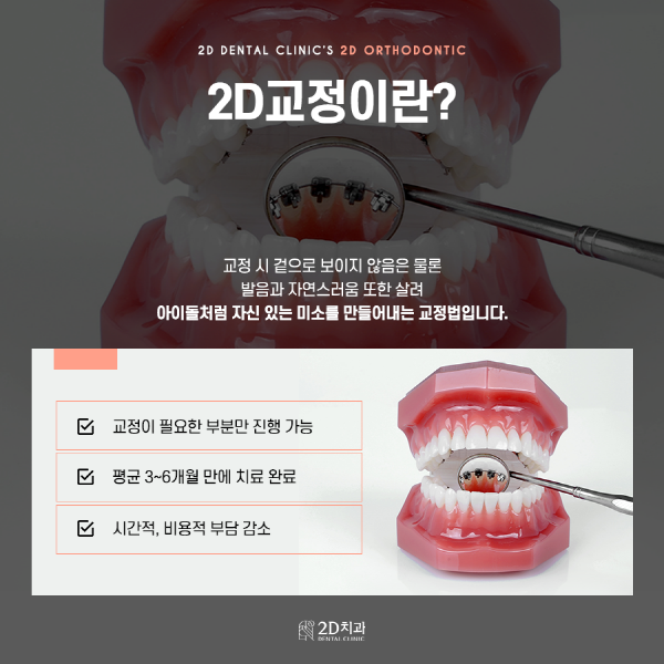 쉿! 아무도 몰라, 티 안 나는 교정 비결 <2D교정> 관련 이미지 2