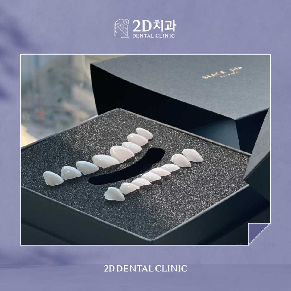 최준희라미네이트 치아착색 블랙필름으로 환해진 얼굴! 관련 이미지 2