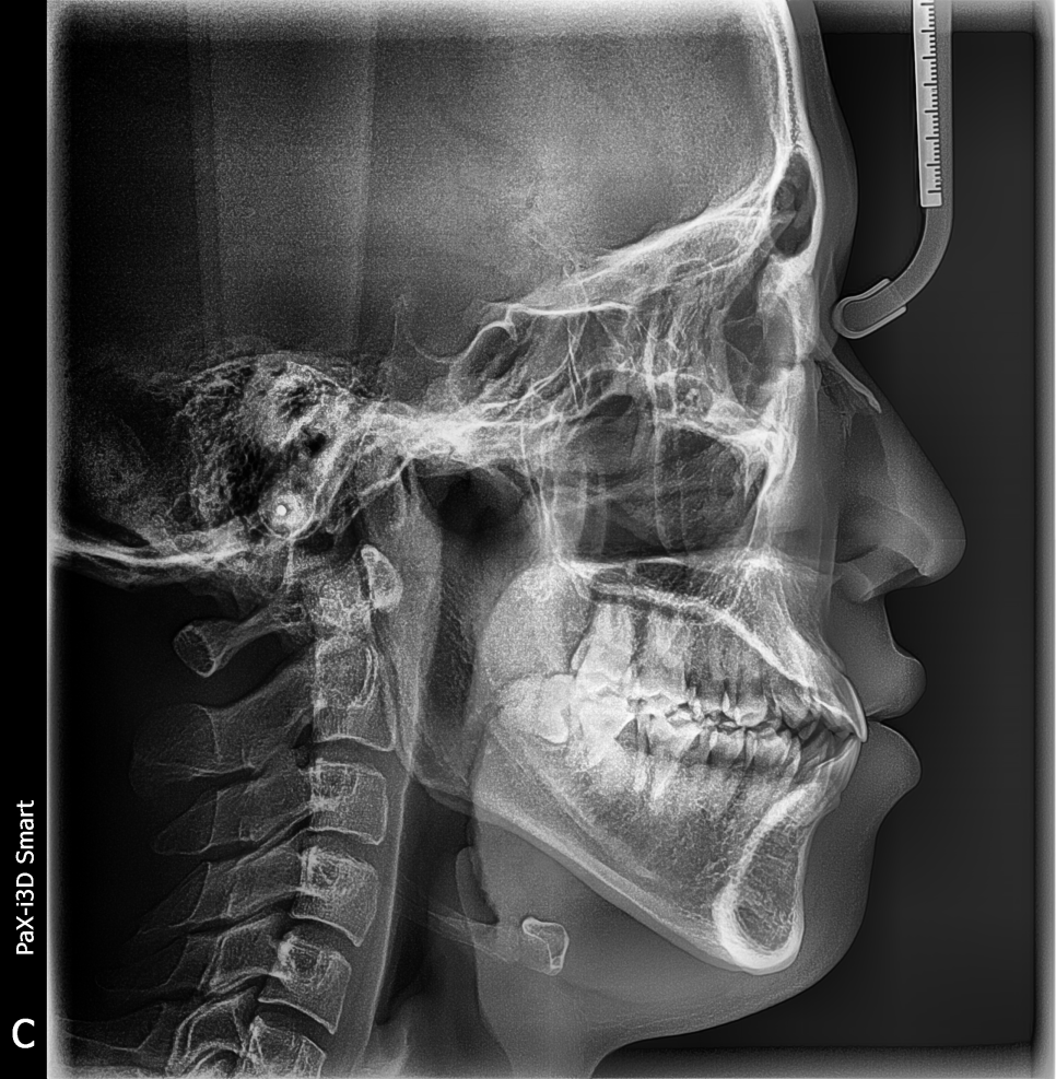 강남역치과 [투디치과] 최대리님 교정진행중/직원들도 믿고 교정해요! 관련 이미지 1