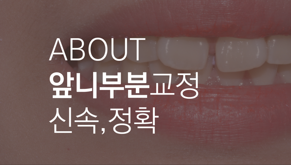 와,앞니 부분교정?!이라고?! 관련 이미지 1