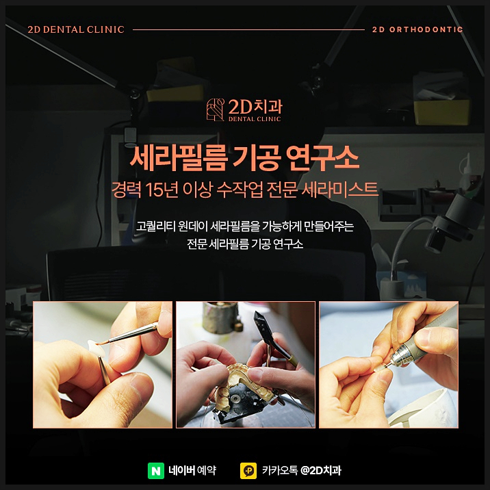 효과적인 설측교정을 위한 정보, 신논현 교정전문의치과 관련 이미지 4