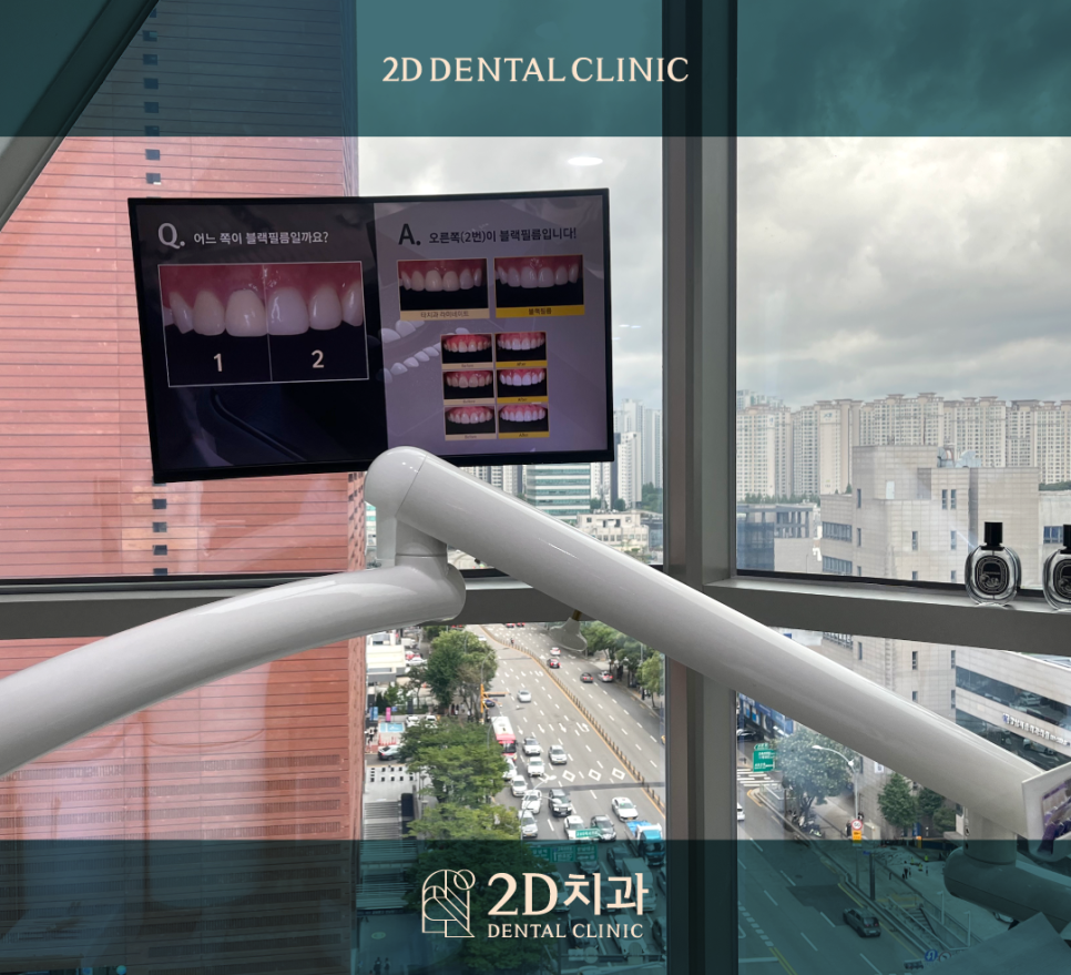 무삭제라미네이트부작용 치아미백치과 누런 이 치료, 망설여진다면 관련 이미지 2