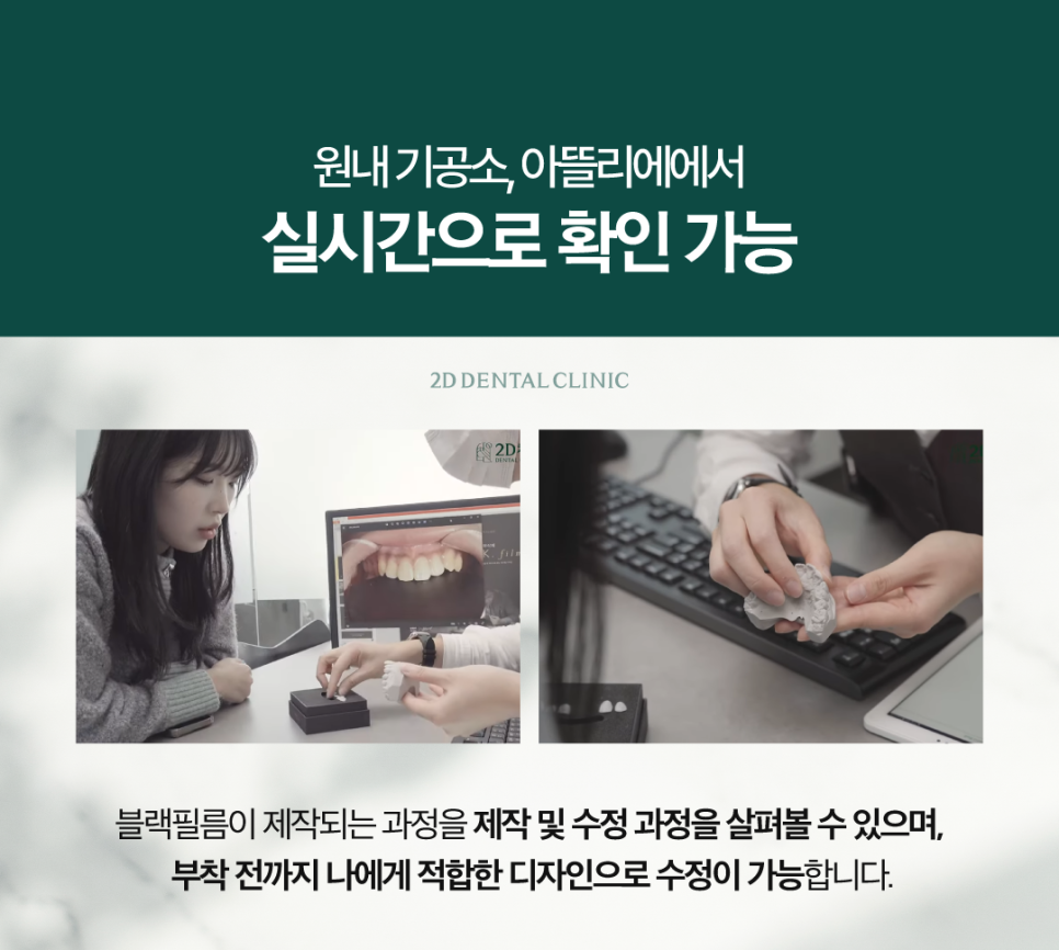 대구무삭제라미네이트 심미치료 숨기지 말고 당당하게 미소 짓기 관련 이미지 6