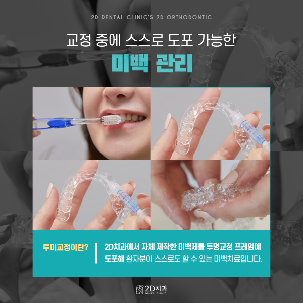 치아교정에 미백을 더하면? 2D치과 <투미교정> 관련 이미지 4