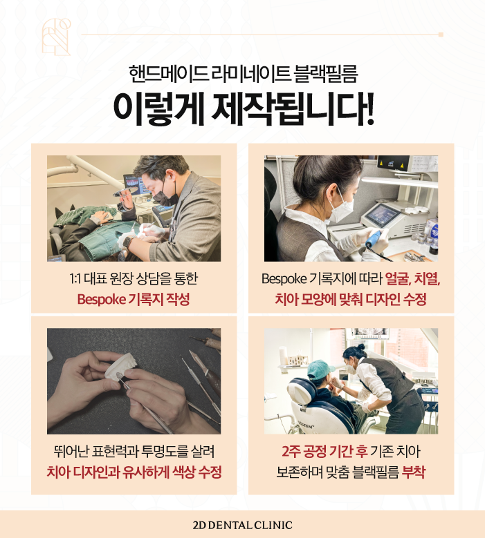 무삭제블랙필름 라미네이트치과 아름다운 미소를 위해 관련 이미지 4