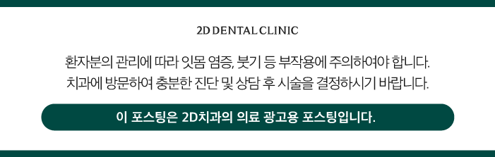 무삭제라미네이트가격 토끼 앞니도 개선이 되나요? 관련 이미지 12