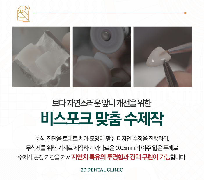 강남라미네이트치과 신논현치과 라미네이트를 고민하고 있다면 관련 이미지 6