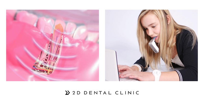 [투디(2D)치과] 1Day(원데이) 투명교정이 특별한 이유! 관련 이미지 5