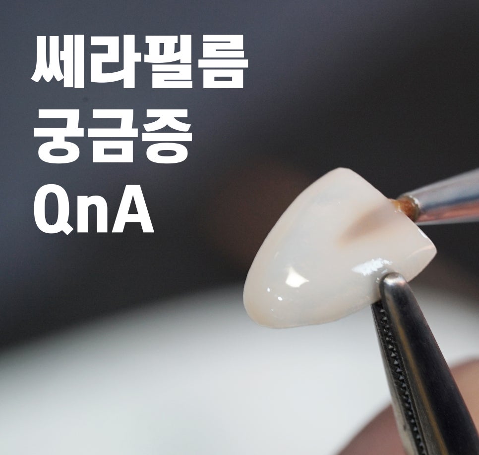 무삭제 쎄라필름의 궁금증 특징?장점? QnA _2D치과(투디치과) 관련 이미지 1