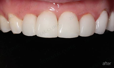 김현진 연애의맛? 또 어디서 봤더라? 관련 이미지 6