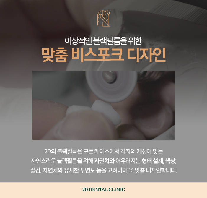 수작업 블랙필름 무삭제라미네이트가격과 장점 관련 이미지 5