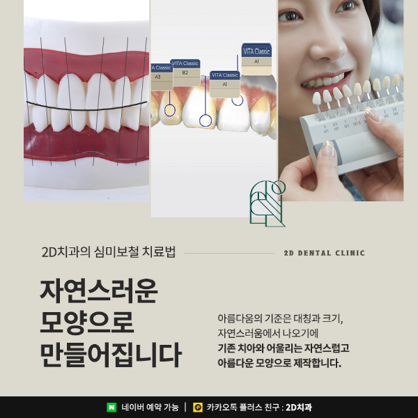 기능과 건강, 아름다움을 동시에! 2D치과의 특별한 심미보철 치료 관련 이미지 5