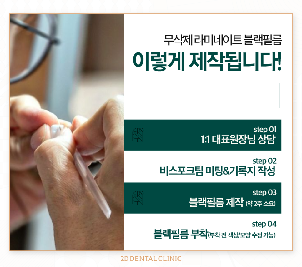 강남라미네이트 심미치료에 적합한 무삭제 블랙필름 관련 이미지 4