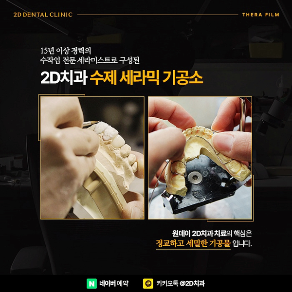 앞니 이빨깨짐 발생했을 때는? 치과라미네이트로! 논현역 세라필름 관련 이미지 4