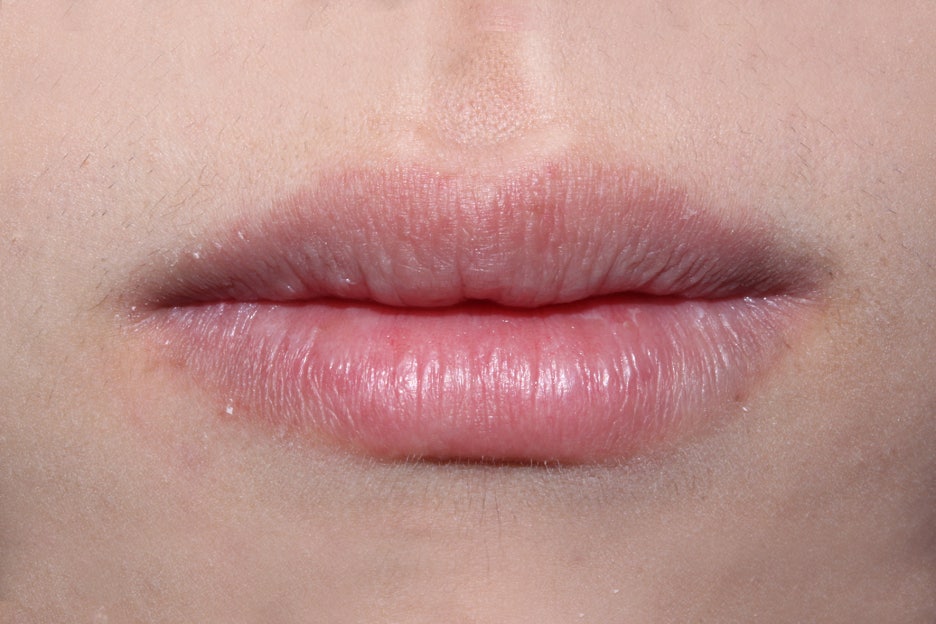 벌어진앞니 치간이개 공간 삭제하기! 관련 이미지 5