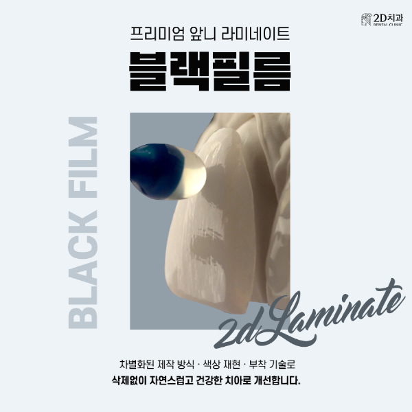 "이건 몰랐지?" 프리미엄 앞니 라미네이트 <블랙필름> 관련 이미지 1
