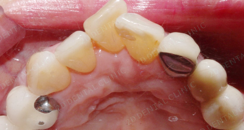 2D치과(투디치과) 교정일기 ㅣ 잇몸질환 예방되는 치아교정(feat.어머님교정) 관련 이미지 2