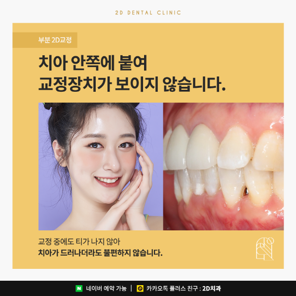 필요한 부분만 부담 없이 빠르게! <부분 2D교정> 관련 이미지 5