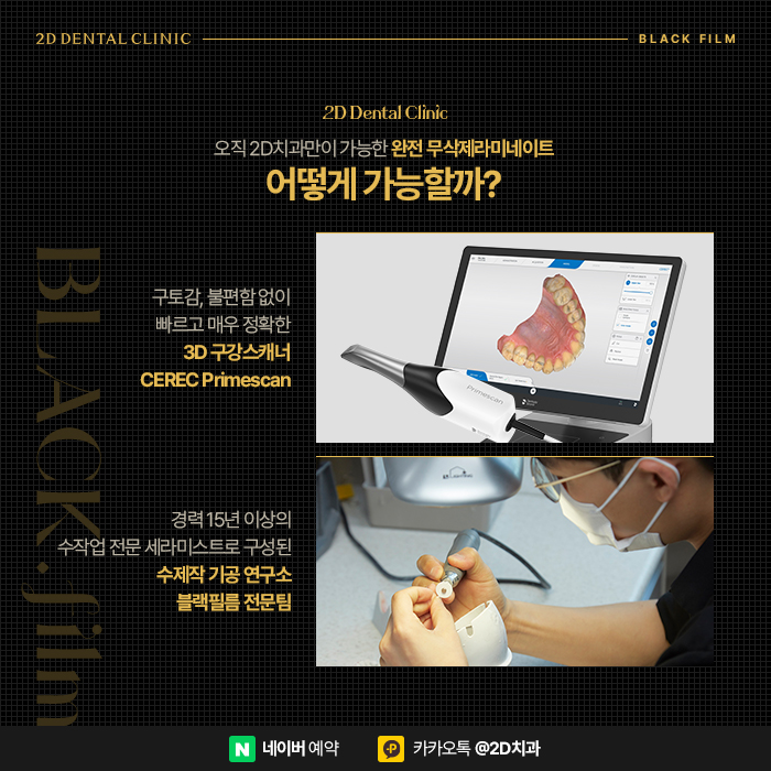 아랫니 라미네이트 가장 중요한 포인트는 삭제량, 완전 무삭제라미네이트 블랙필름 관련 이미지 3