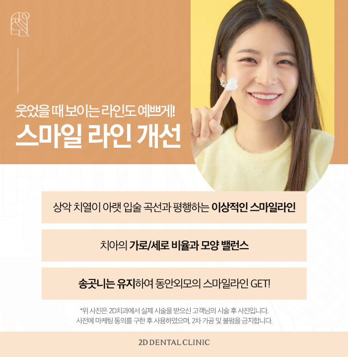 무삭제라미네이트비용 부담은 줄이면서 아름다운 치아로 관련 이미지 5