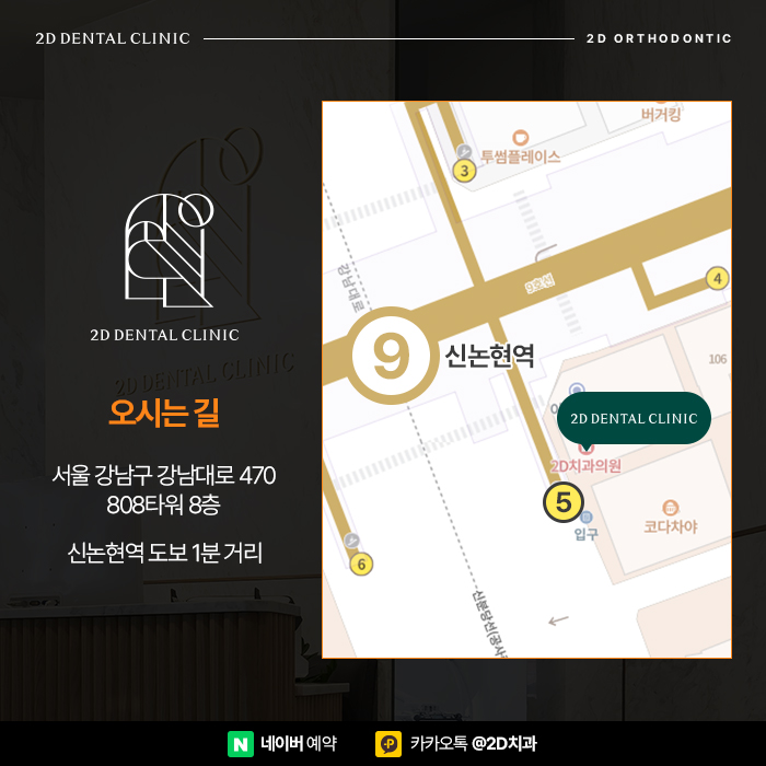 토끼앞니 강남역 2D교정으로 고르게 관련 이미지 5