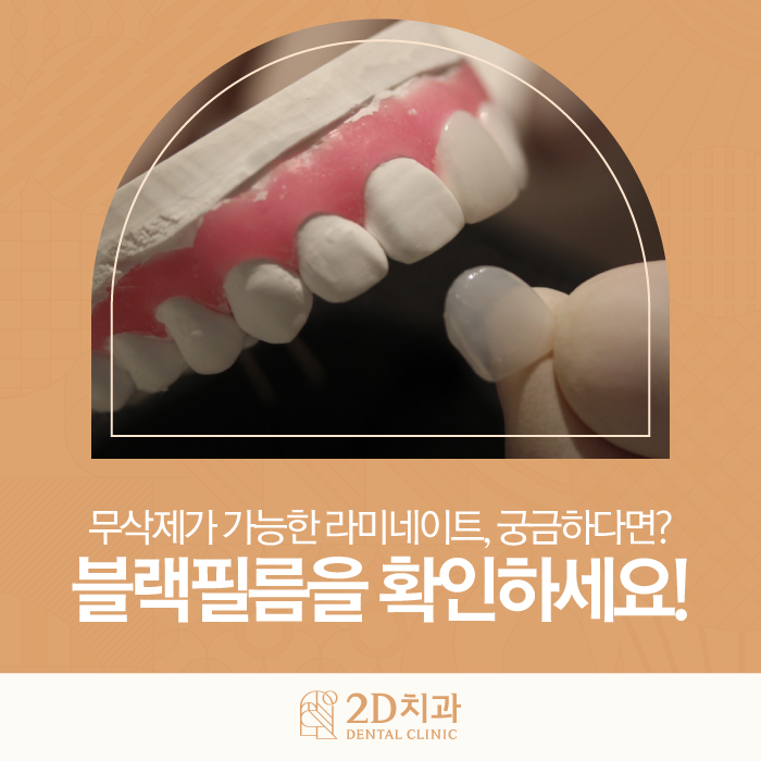 강남라미네이트 단점은 줄이고 장점은 높인 무삭제 블랙필름 관련 이미지 1